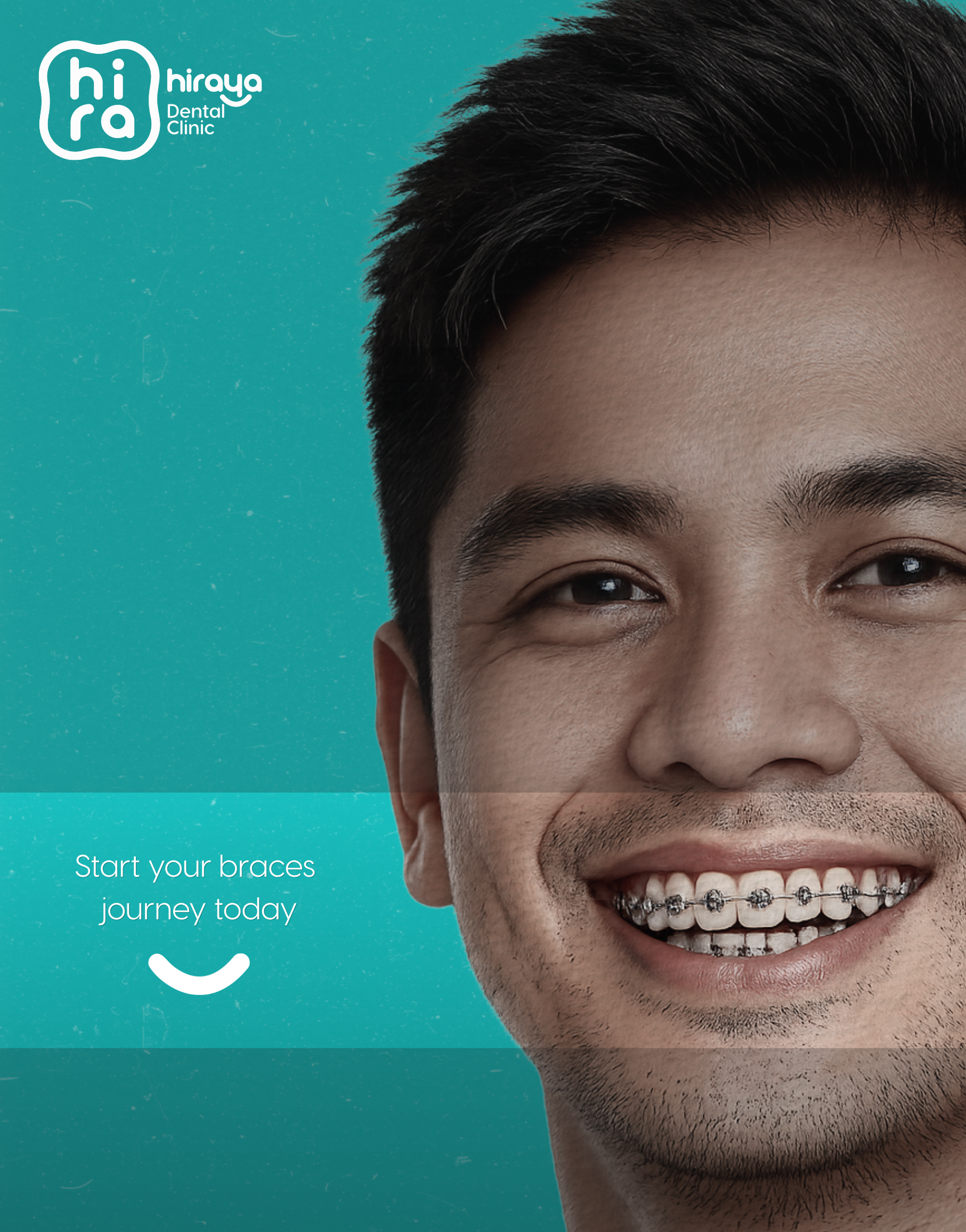 Dental braces